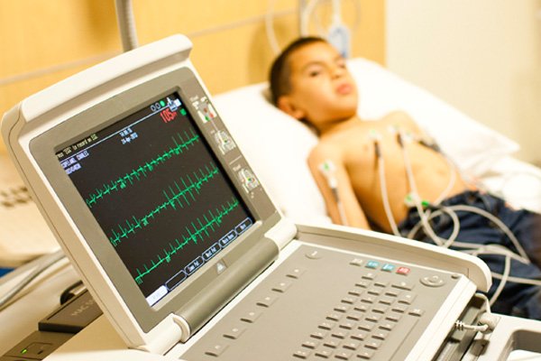 ECG